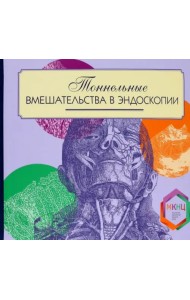 Тоннельные вмешательства в эндоскопии