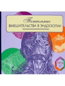 Тоннельные вмешательства в эндоскопии Тоннельные вмешательства в эндоскопии