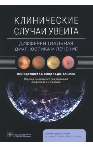 Клинические случаи увеита. Дифференциальная диагностика и лечение