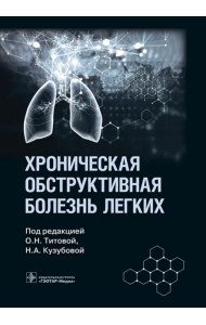 Хроническая обструктивная болезнь легких. Руководство