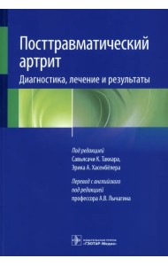 Посттравматический артрит. Диагностика, лечение и результаты