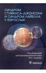 Синдром Стивенса-Джонсона и синдром Лайелла у взрослых