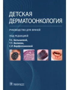 Детская дерматоонкология. Руководство для врачей Детская дерматоонкология. Руководство для врачей