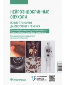 Нейроэндокринные опухоли. Новые принципы диагностики и лечения. Руководство Нейроэндокринные опухоли. Новые принципы диагностики и лечения. Руководство