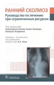 Ранний сколиоз. Руководство по лечению при ограниченных ресурсах
