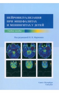 Нейровизуализация при энцефалитах и менингитах у детей