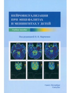 Нейровизуализация при энцефалитах и менингитах у детей