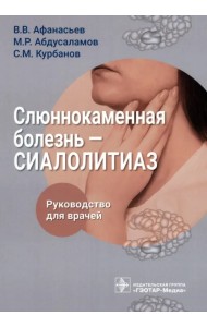 Слюннокаменная болезнь – сиалолитиаз