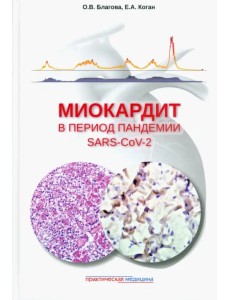 Миокардит в период пандемии SARS-CoV-2