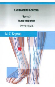 Варикозная болезнь. Часть 3. Склеротерапия. Курс лекций