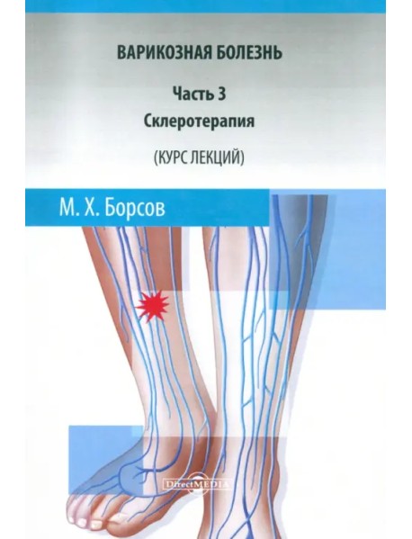 Варикозная болезнь. Часть 3. Склеротерапия. Курс лекций