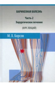Варикозная болезнь. Часть 2. Хирургическое лечение. Курс лекций. Учебное пособие
