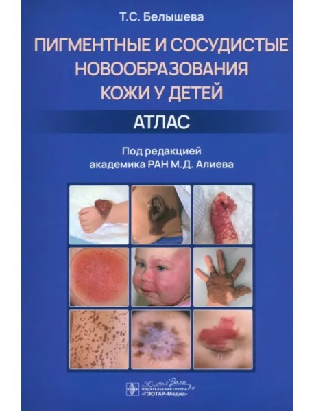 Пигментные и сосудистые новообразования кожи у детей. Атлас