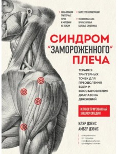Синдром «замороженного» плеча. Терапия триггерных точек для преодоления боли и восстановления