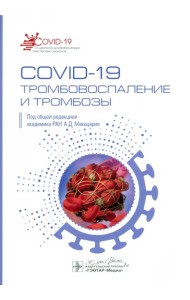 COVID-19. Тромбовоспаление и тромбозы