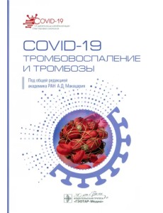 COVID-19. Тромбовоспаление и тромбозы