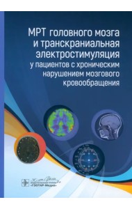 МРТ головного мозга и транскраниальная электростимуляция у пациентов с хроническим нарушением
