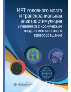 МРТ головного мозга и транскраниальная электростимуляция у пациентов с хроническим нарушением МРТ головного мозга и транскраниальная электростимуляция у пациентов с хроническим нарушением