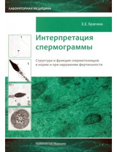 Интерпретация спермограммы. Структура и функция сперматозоидов в норме и при нарушении фертильности Интерпретация спермограммы. Структура и функция сперматозоидов в норме и при нарушении фертильности