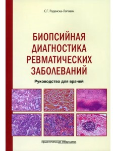 Биопсийная диагностика ревматических заболеваний. Руководство для врачей Биопсийная диагностика ревматических заболеваний. Руководство для врачей