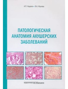 Патологическая анатомия акушерских заболеваний Патологическая анатомия акушерских заболеваний