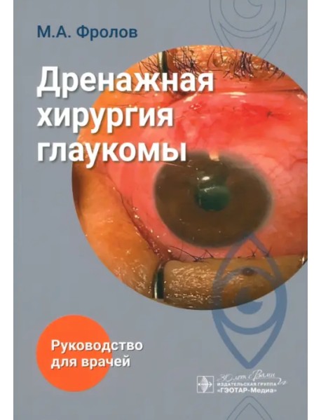 Дренажная хирургия глаукомы