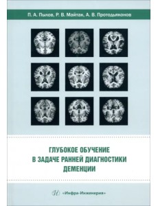 Глубокое обучение в задаче ранней диагностики деменции Глубокое обучение в задаче ранней диагностики деменции