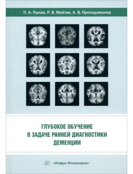 Глубокое обучение в задаче ранней диагностики деменции