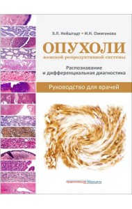 Опухоли женской репродуктивной системы. Распознавание и дифференциальная диагностика. Руководство