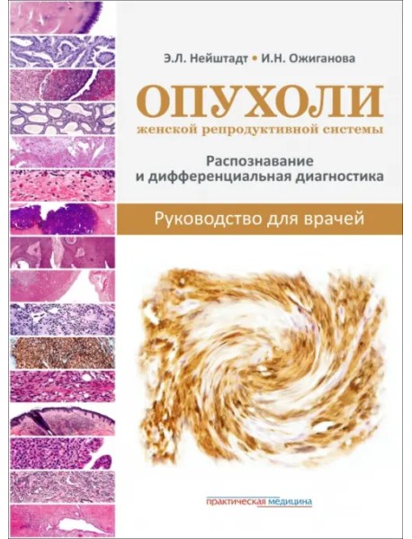 Опухоли женской репродуктивной системы. Распознавание и дифференциальная диагностика. Руководство