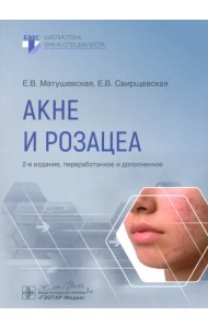 Акне и розацеа