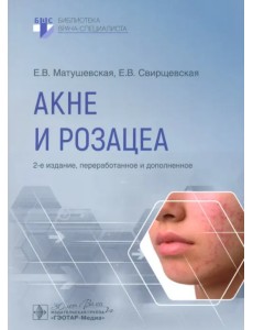 Акне и розацеа Акне и розацеа