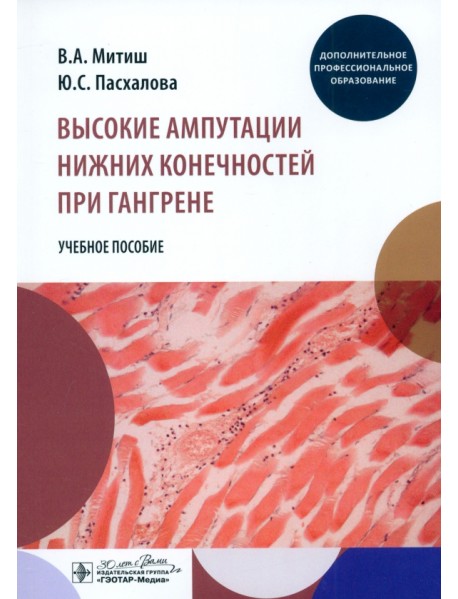 Высокие ампутации нижних конечностей при гангрене. Учебное пособие