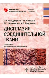 Дисплазия соединительной ткани