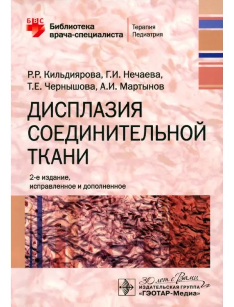 Дисплазия соединительной ткани