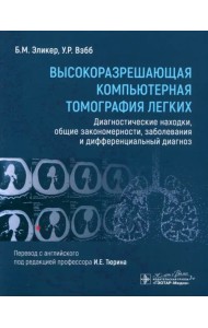 Высокоразрешающая компьютерная томография легких. Диагностические находки, общие закономерности, заболевания и дифференциальный диагноз