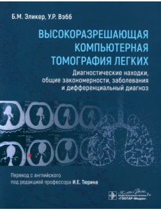 Высокоразрешающая компьютерная томография легких. Диагностические находки, общие закономерности, заболевания и дифференциальный диагноз Высокоразрешающая компьютерная томография легких. Диагностические находки, общие закономерности, заболевания и дифференциальный диагноз