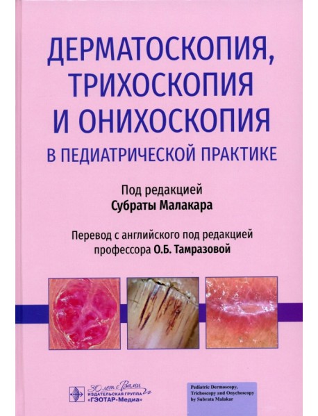 Дерматоскопия, трихоскопия и онихоскопия в педиатрической практике