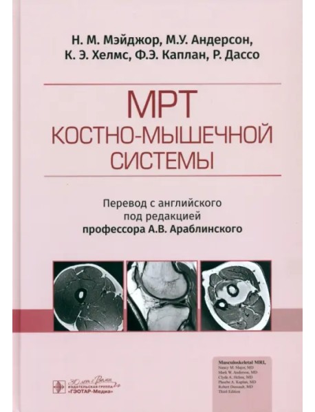 МРТ костно-мышечной системы