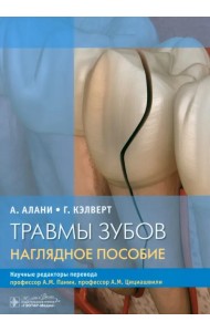Травмы зубов. Наглядное пособие