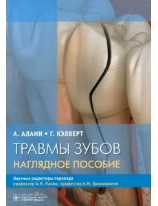 Травмы зубов. Наглядное пособие