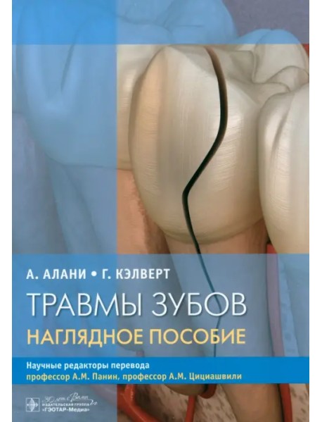 Травмы зубов. Наглядное пособие