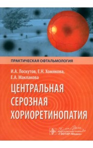 Центральная серозная хориоретинопатия
