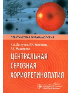 Центральная серозная хориоретинопатия