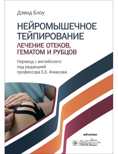 Нейромышечное тейпирование. Лечение отеков, гематом и рубцов