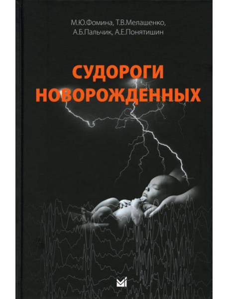 Судороги новорожденных