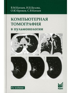 Компьютерная томография в пульмонологии. 4-е изд Компьютерная томография в пульмонологии. 4-е изд