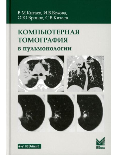 Компьютерная томография в пульмонологии. 4-е изд