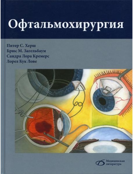 Офтальмохирургия