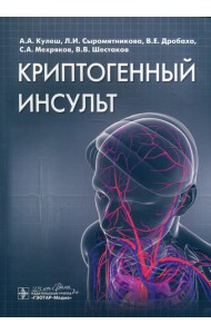 Криптогенный инсульт: руководство